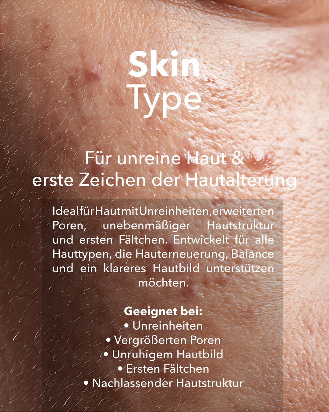 S³ SHOT DERMAPure